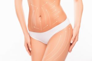 LIPOSUZIONE DONNA ROMA